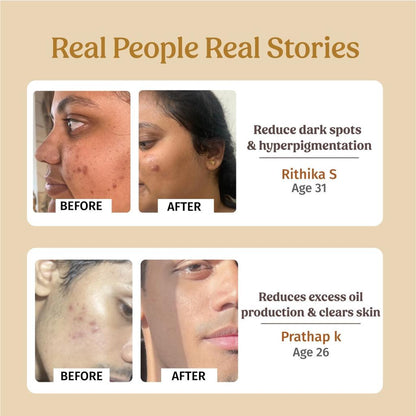 7-in-1 Skin Glow Facial Kit (Salon Results at Home)