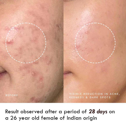7-in-1 Skin Glow Facial Kit (Salon Results at Home)